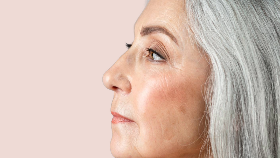 Dry and Dehydrated Skin