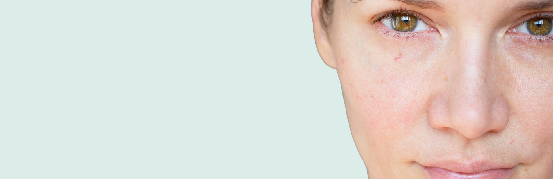 Dry and Dehydrated Skin