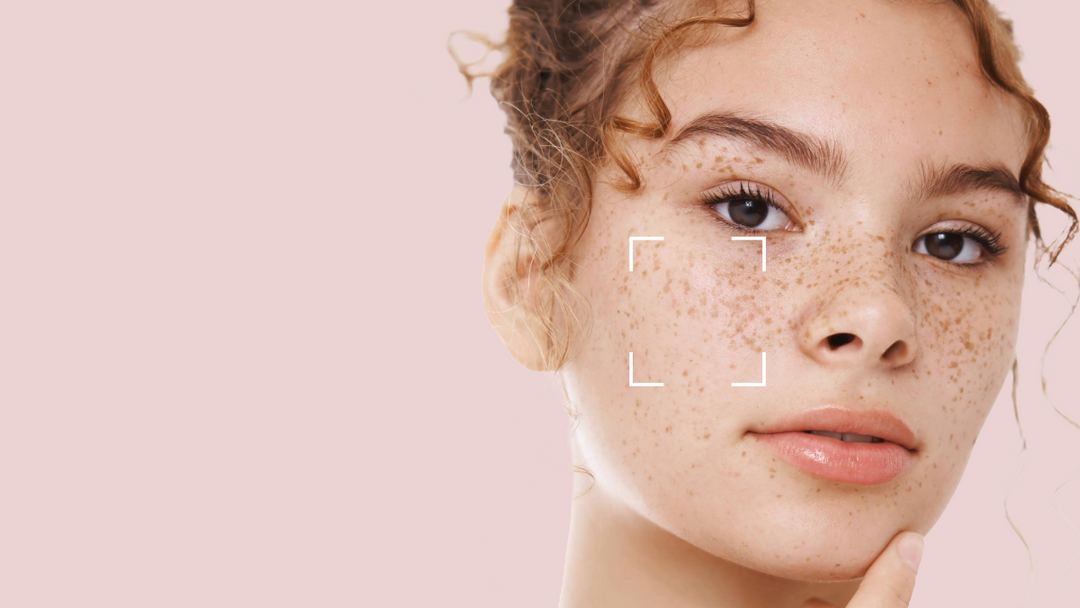 Uneven Skin