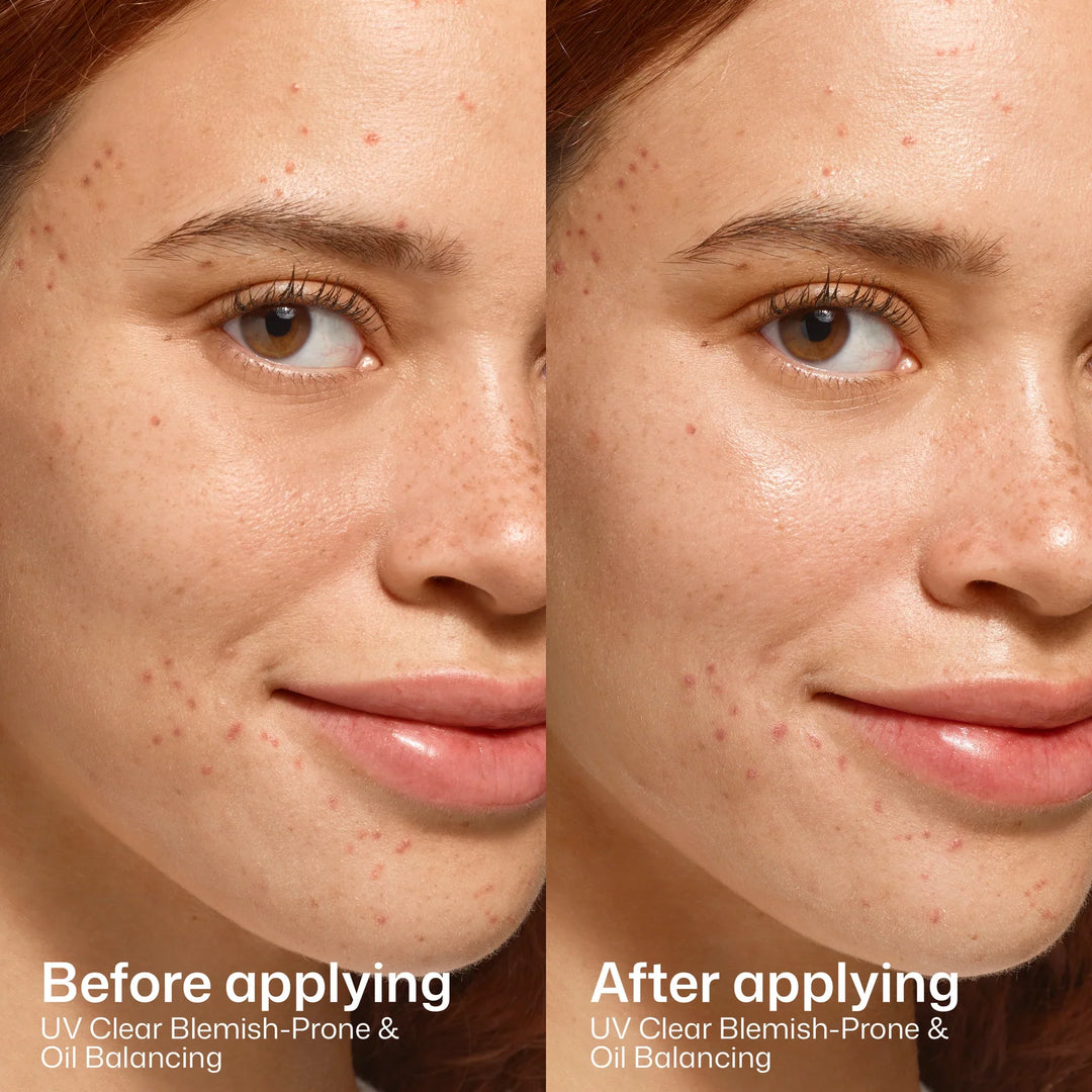EltaMD - UV Clear Blemish-Prone &amp; Oil Balancing SPF 50