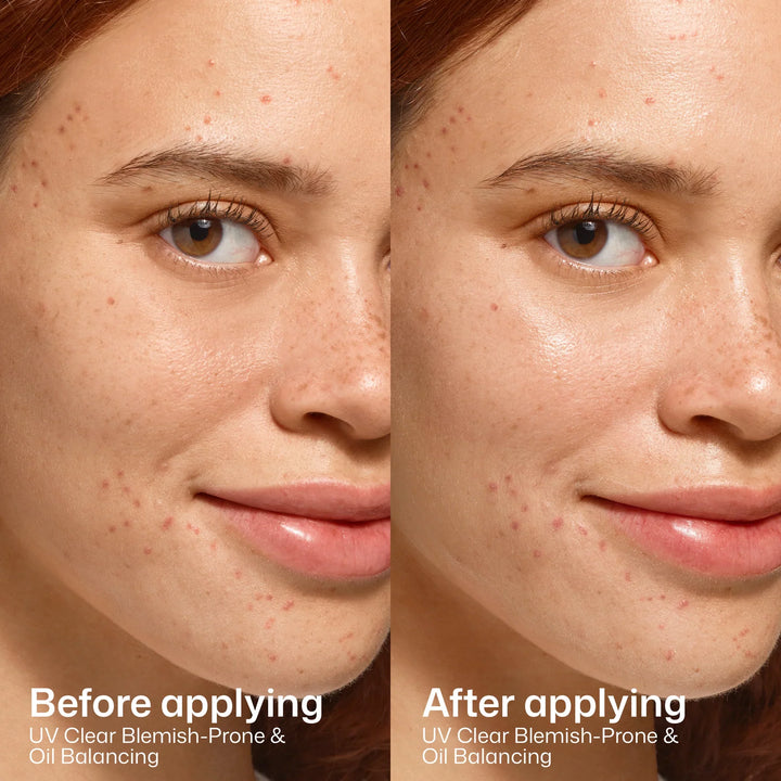 EltaMD - UV Clear Blemish-Prone &amp; Oil Balancing SPF 50