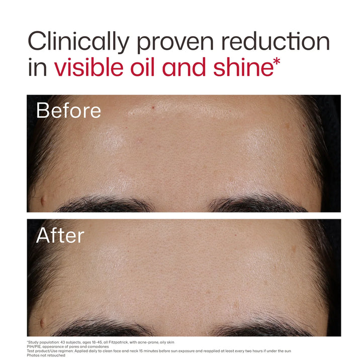 EltaMD - UV Clear Blemish-Prone &amp; Oil Balancing SPF 50