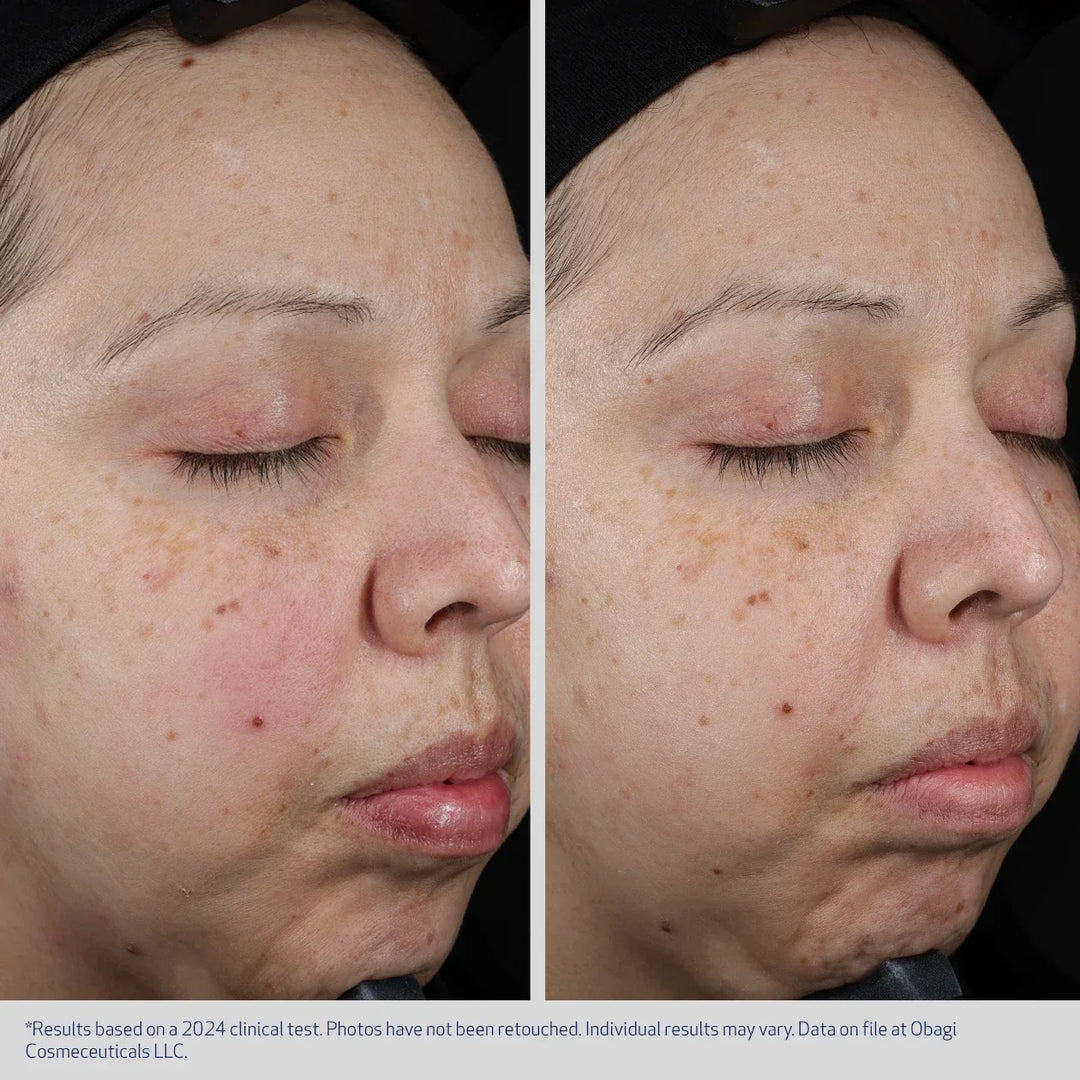 Obagi - SUZANOBAGIMD® MOISTURE RESTORE