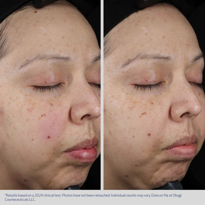 Obagi - SUZANOBAGIMD® MOISTURE RESTORE