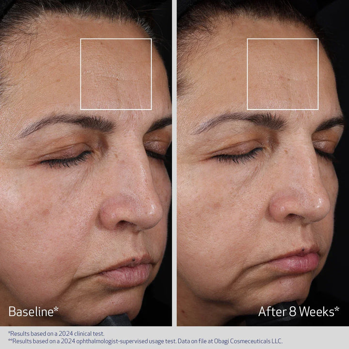 Obagi - ELASTIDERM® ADVANCED FILLER CONCENTRATE