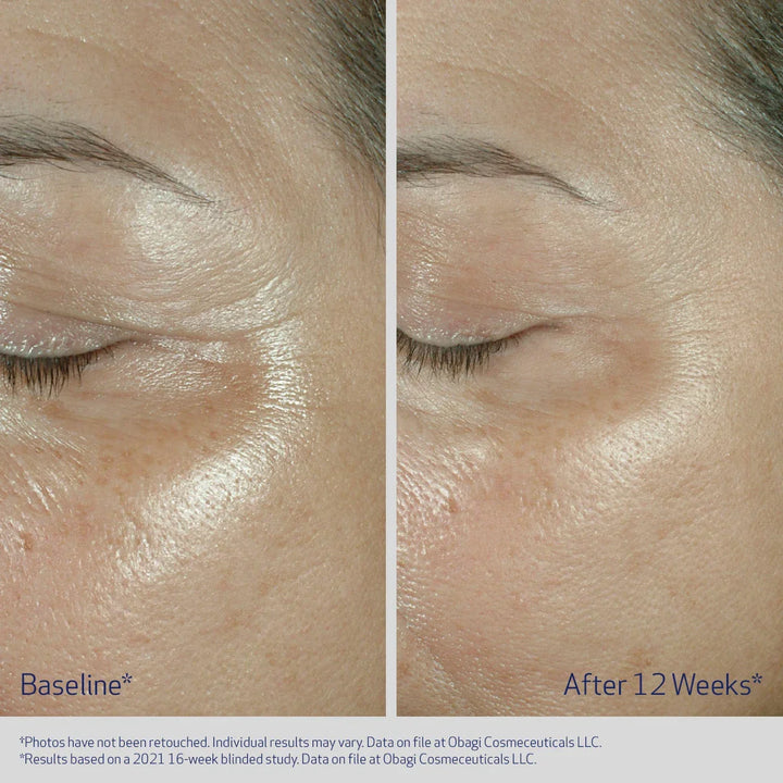 Obagi - ELASTIDERM® EYE CREAM