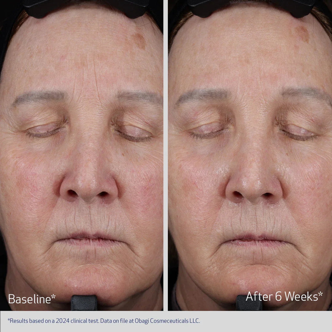 Obagi - ELASTIDERM® LIFT UP &amp; SCULPT FACIAL MOISTURIZER