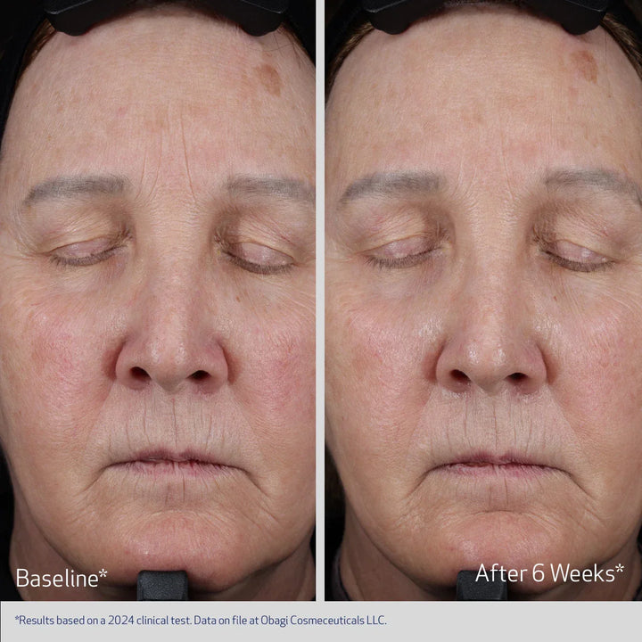 Obagi - ELASTIDERM® LIFT UP &amp; SCULPT FACIAL MOISTURIZER