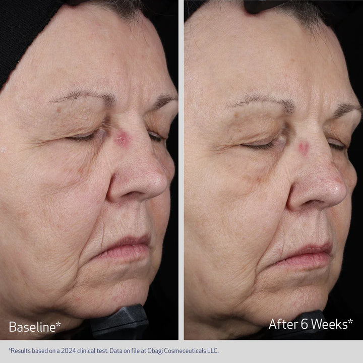 Obagi - ELASTIDERM® LIFT UP &amp; SCULPT FACIAL MOISTURIZER