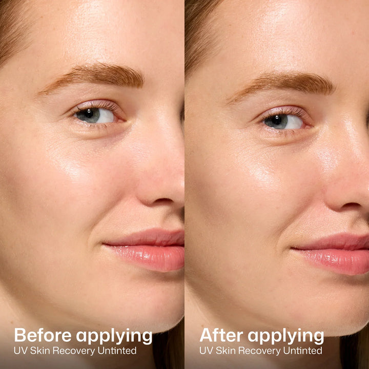 EltaMD - UV Skin Recovery Red Color Correcting Green Tint Broad Spectrum SPF 50
