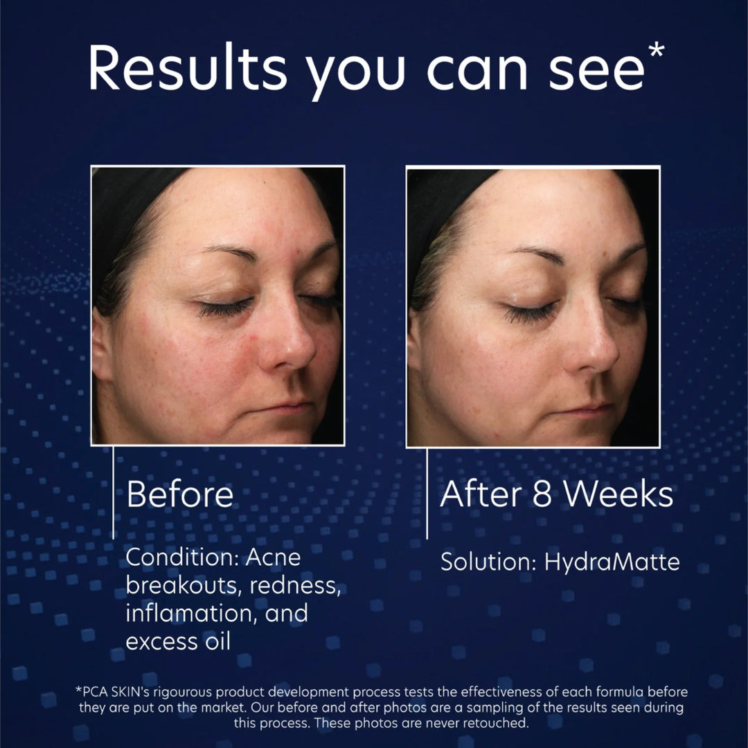 PCA Skin - HydraMatte