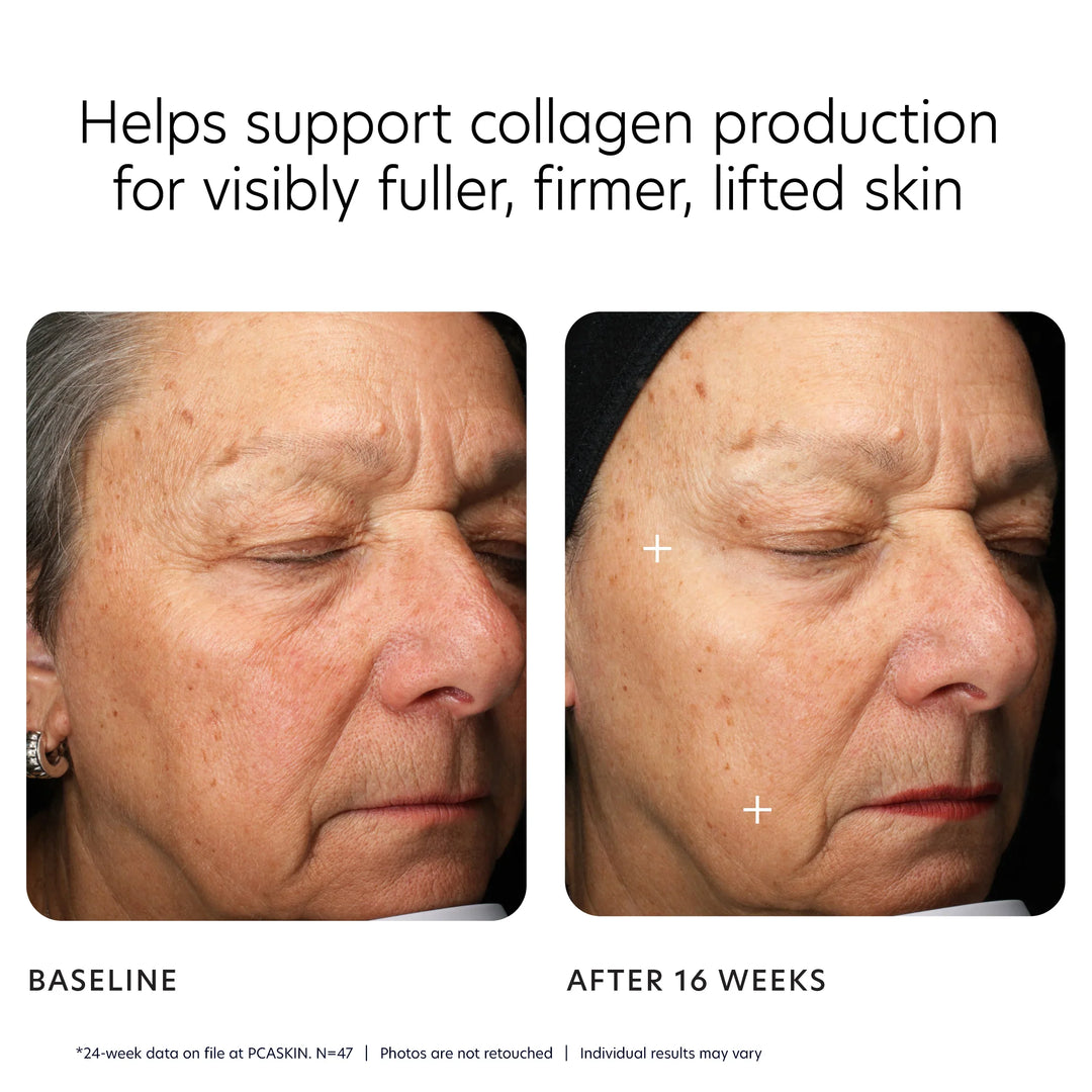 PCA Skin - MGF Age Renewal Cream
