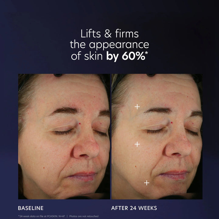 PCA Skin - Pro-Max Age Renewal