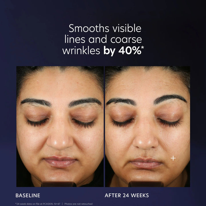 PCA Skin - Pro-Max Age Renewal