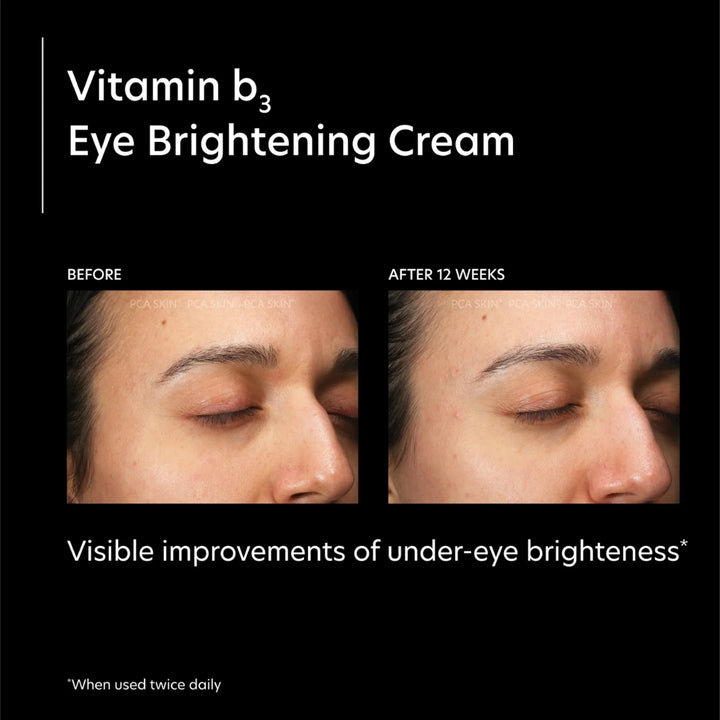 PCA Skin - Vitamin B3 Eye Brightening Cream