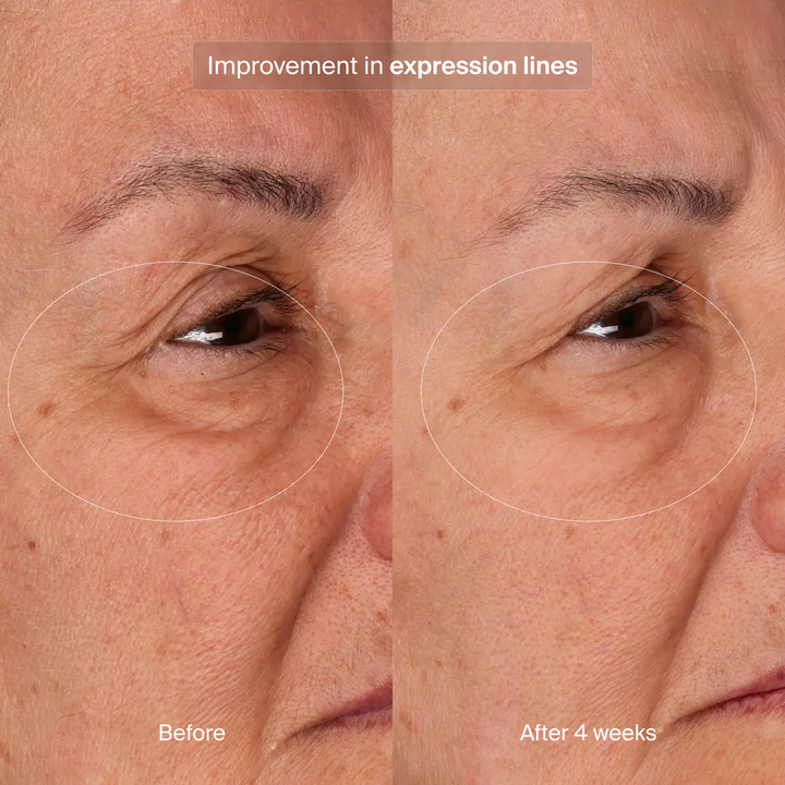 Pavise - Bioadaptive Stress Repair