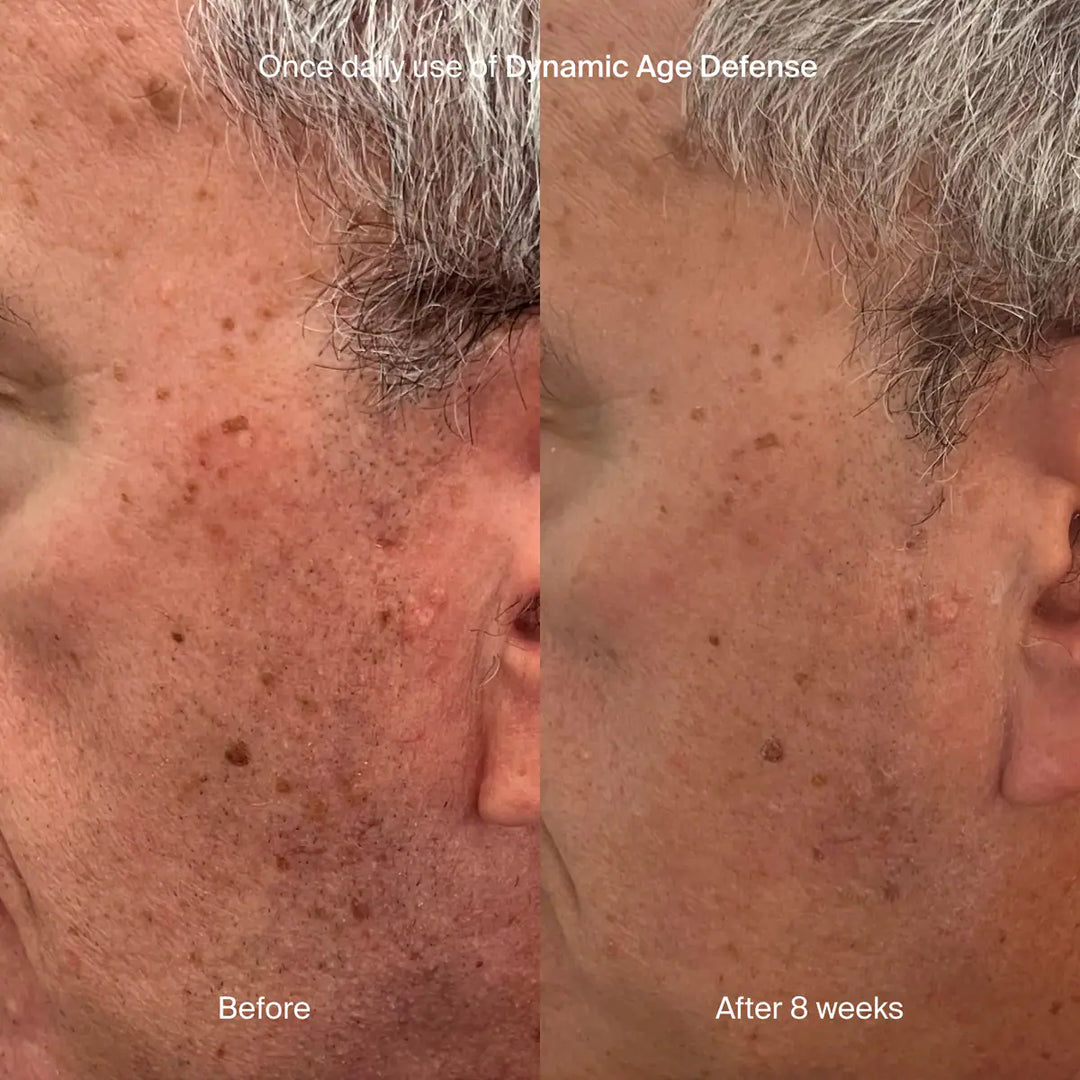 Pavise - Dynamic Age Defense
