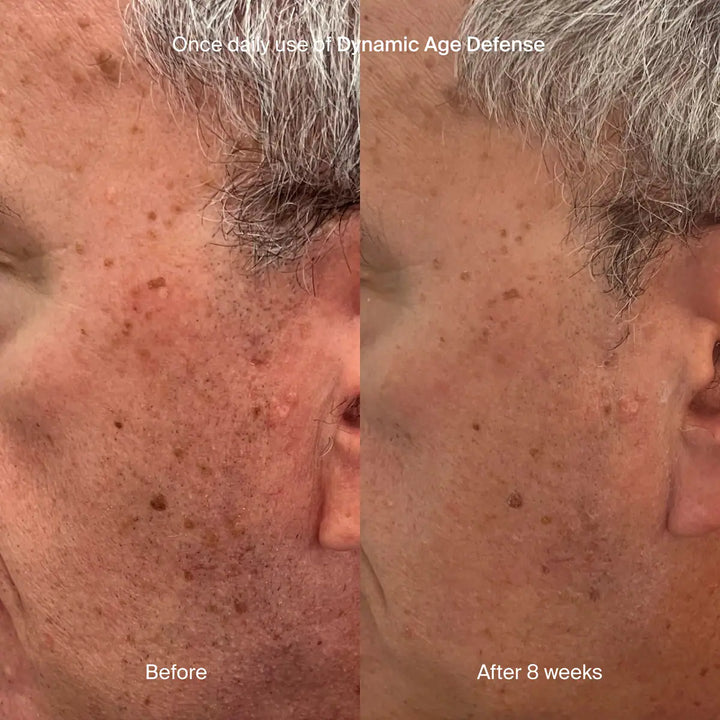 Pavise - Dynamic Age Defense