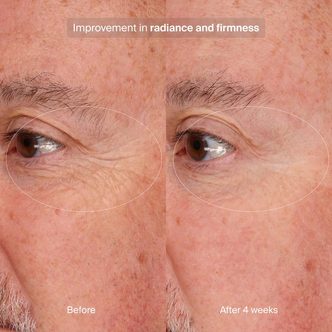 Pavise - Precision Eye Lift