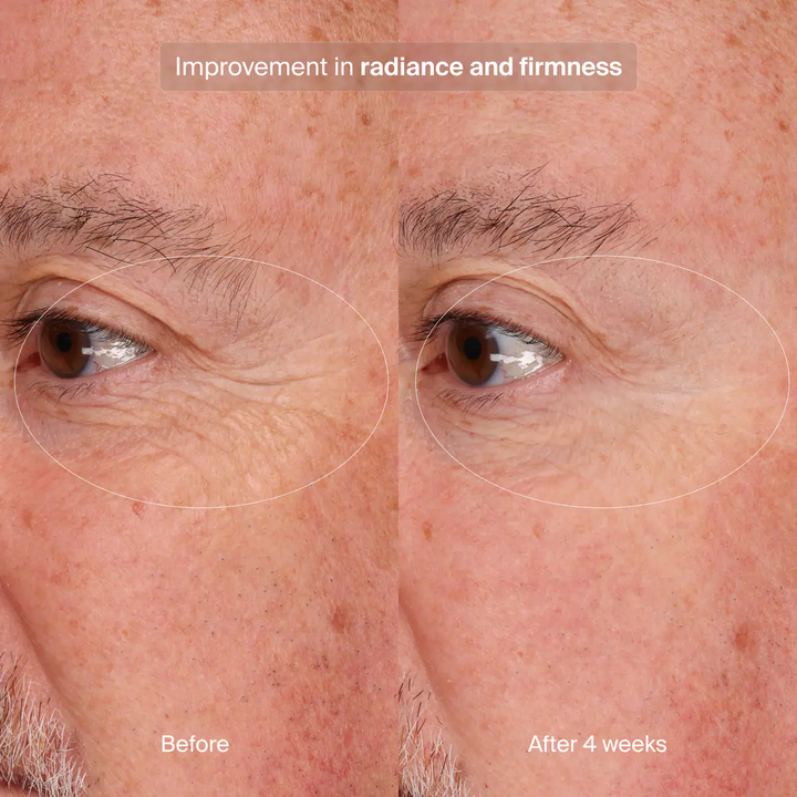 Pavise - Precision Eye Lift
