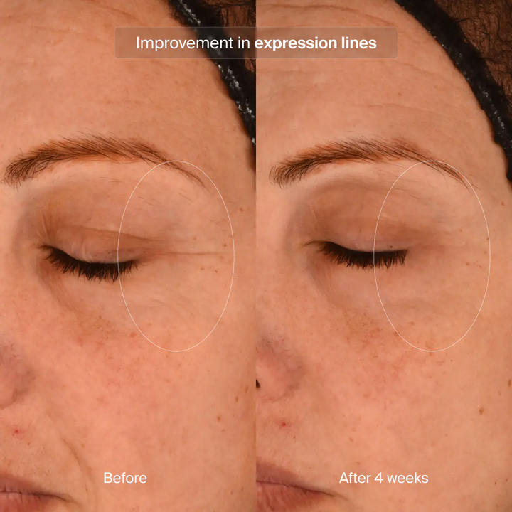 Pavise - Precision Eye Lift