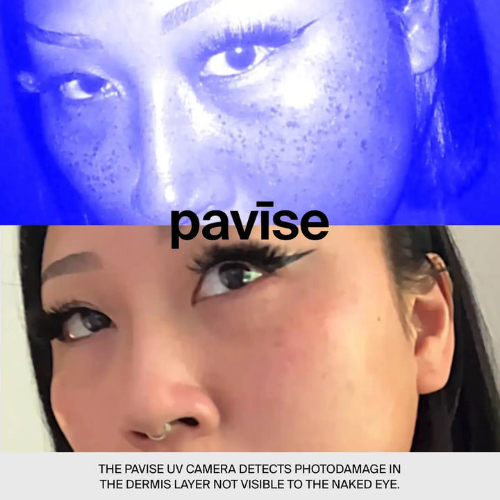 Pavise - UV Camera
