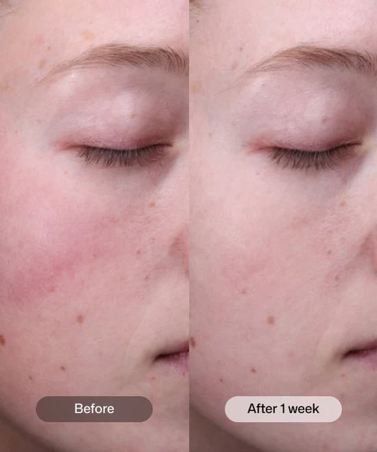 Revision - Radiance+ Resurfacing Serum