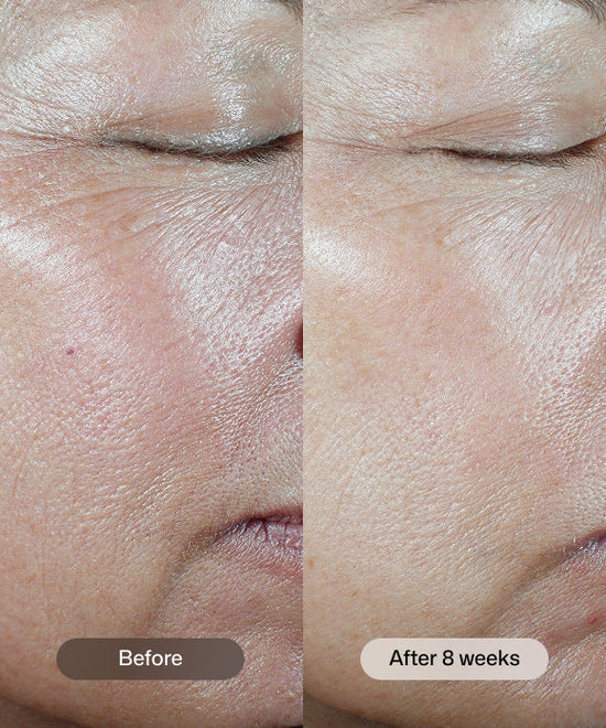 Revision - C+ Correcting Complex 30%