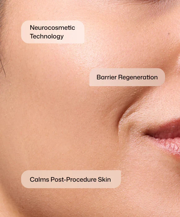 Revision - CMT Post-Procedure Cream