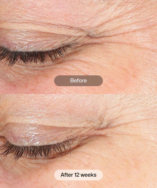 Revision - Revox Line Relaxer