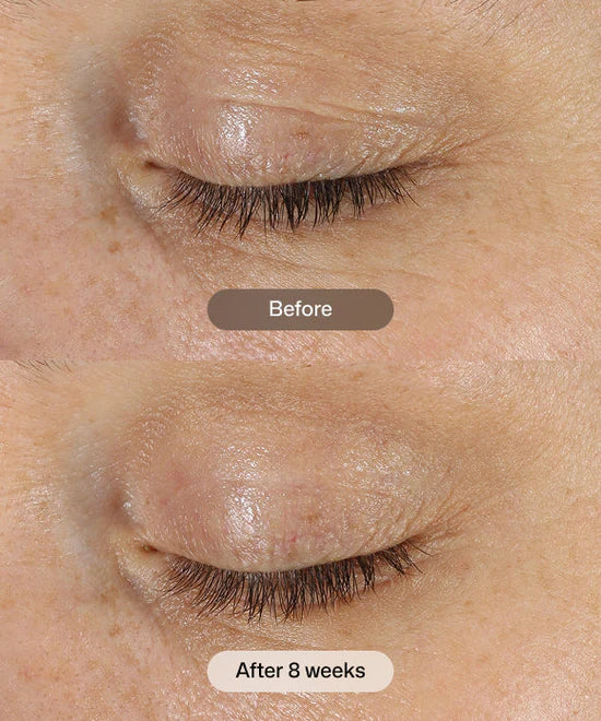 Revision - D·E·J Eye Cream