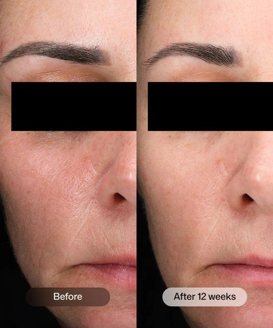 Revision - D·E·J Daily Boosting Serum™