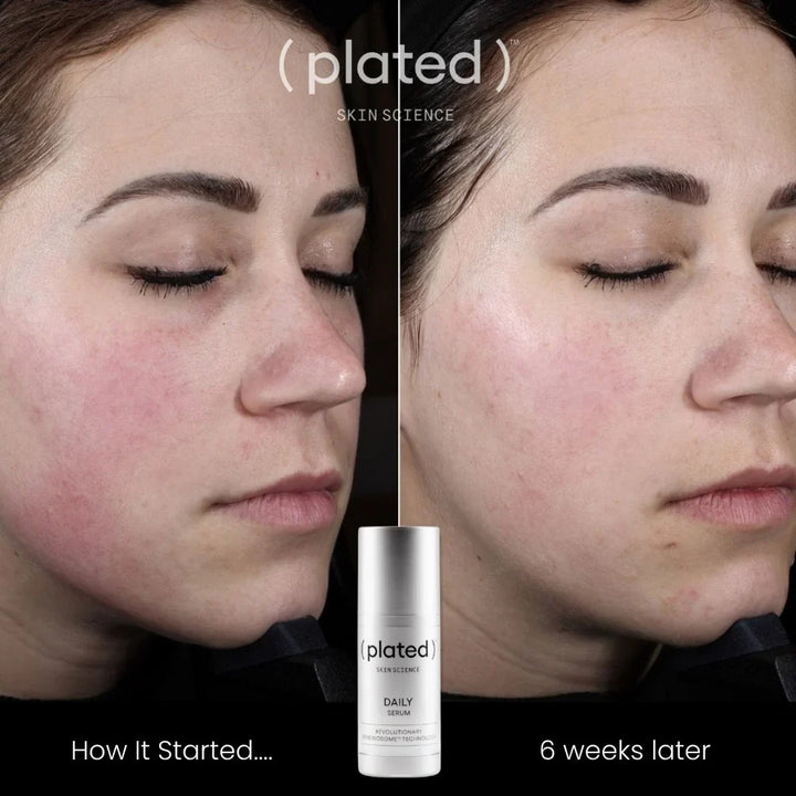 Plated - Daily Serum