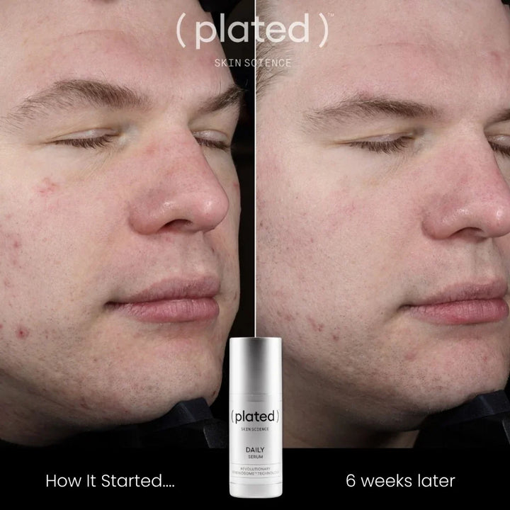 Plated - Daily Serum
