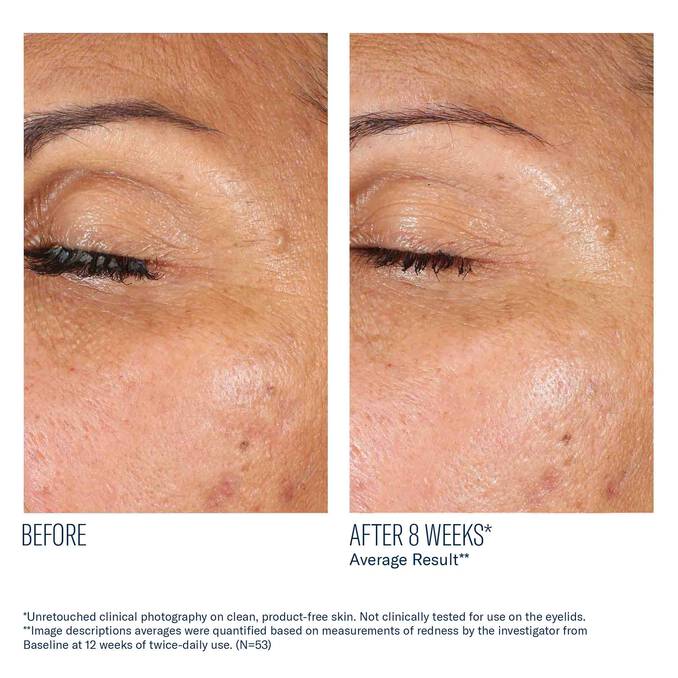 SkinBetter Science - EyeMax AlphaRet Overnight Cream